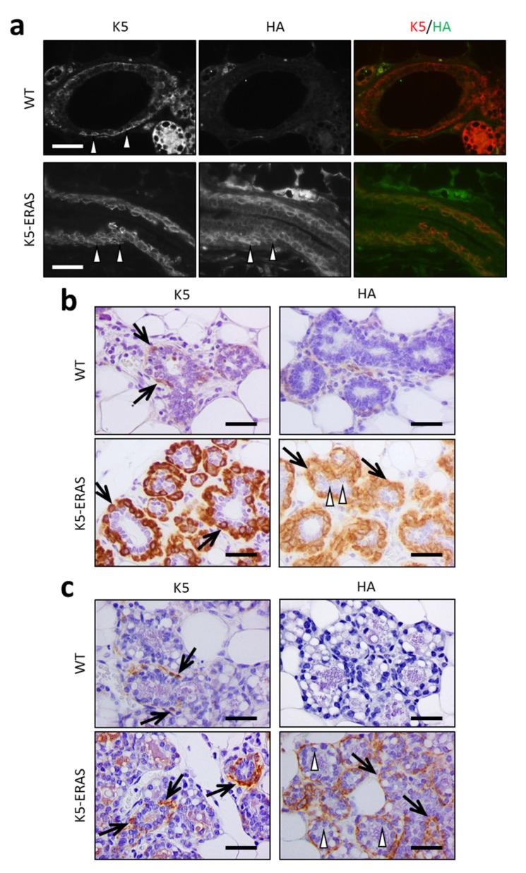 https://cdn.ncbi.nlm.nih.gov/pmc/blobs/7aa9/8582886/9933c6db9cae/cancers-13-05588-g003.jpg