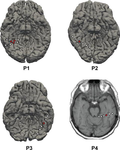 https://cdn.ncbi.nlm.nih.gov/pmc/blobs/7aae/4339092/a42b5992bfa0/nihms-638369-f0001.jpg