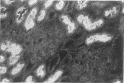 https://cdn.ncbi.nlm.nih.gov/pmc/blobs/7aaf/1879902/242a907487f2/amjpathol00125-0181-a.jpg