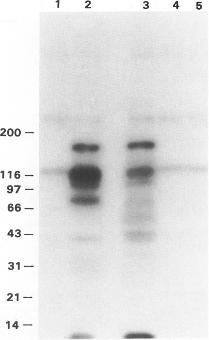 https://cdn.ncbi.nlm.nih.gov/pmc/blobs/7aaf/1879902/37ef4d9ecfd0/amjpathol00125-0185-b.jpg