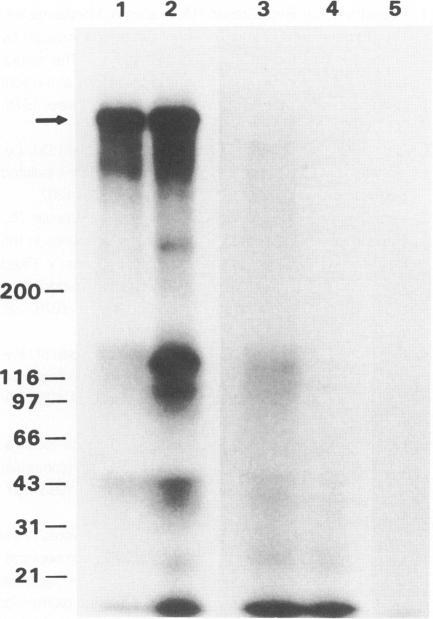https://cdn.ncbi.nlm.nih.gov/pmc/blobs/7aaf/1879902/58696ff946d9/amjpathol00125-0185-a.jpg