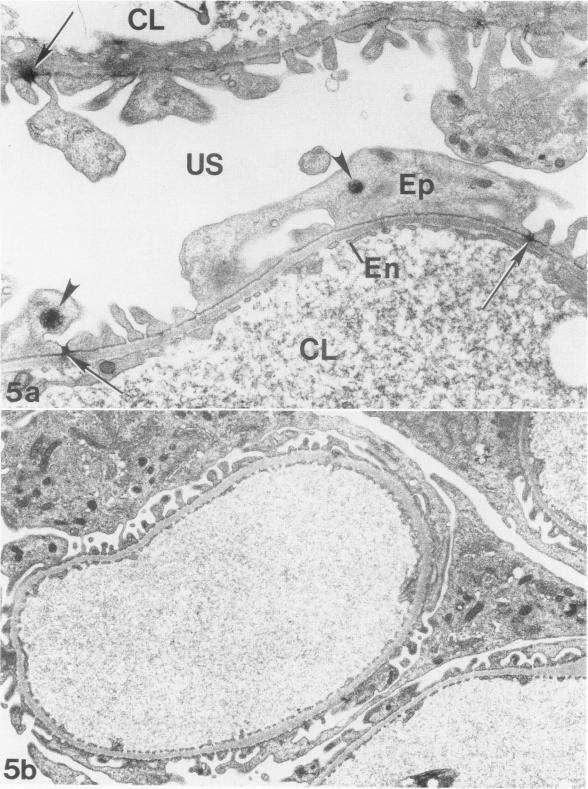 https://cdn.ncbi.nlm.nih.gov/pmc/blobs/7aaf/1879902/65c0f1db5945/amjpathol00125-0184-a.jpg