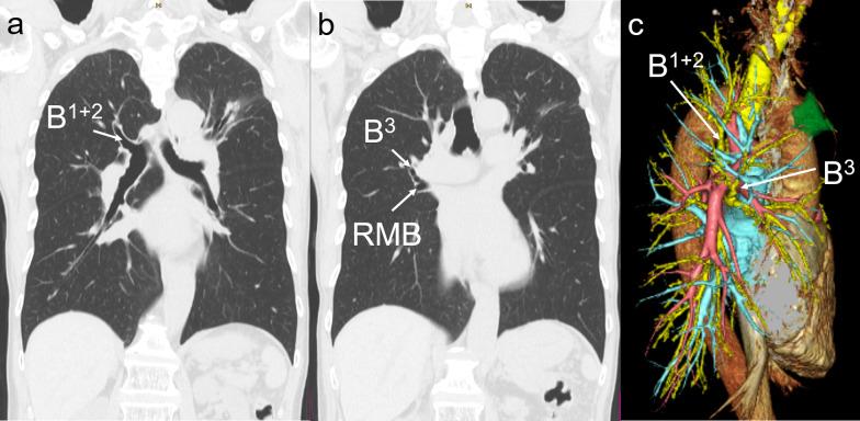https://cdn.ncbi.nlm.nih.gov/pmc/blobs/7ab1/11324617/77f793815222/40792_2024_1986_Fig1_HTML.jpg