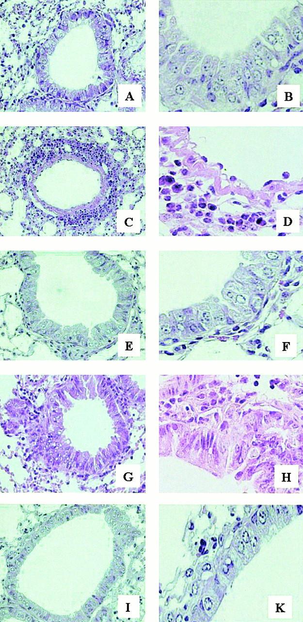 https://cdn.ncbi.nlm.nih.gov/pmc/blobs/7ab4/2193377/cbe85fa9dc67/JEM001310.f4.jpg