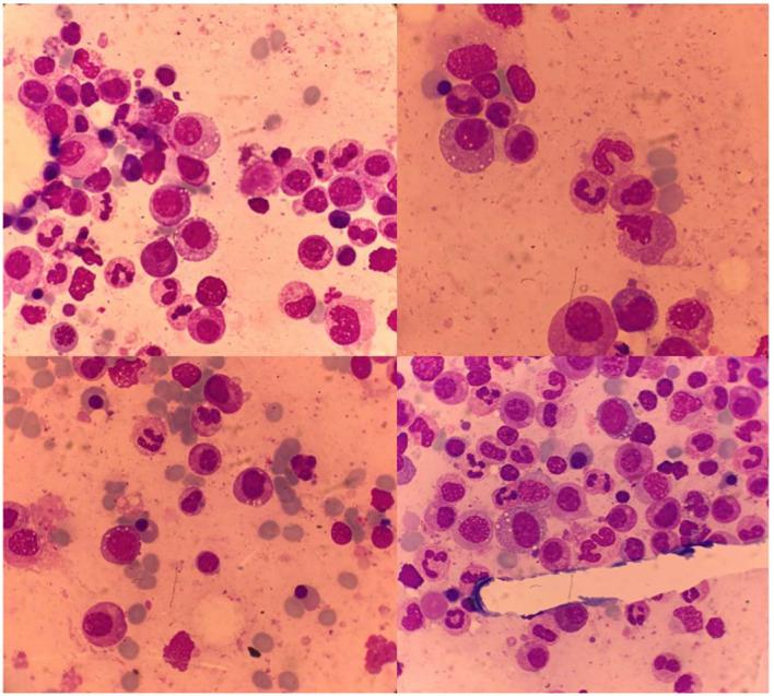 https://cdn.ncbi.nlm.nih.gov/pmc/blobs/7ab7/11150609/aca57d882ad5/fimmu-15-1403808-g003.jpg