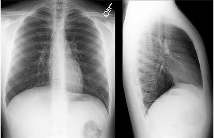 https://cdn.ncbi.nlm.nih.gov/pmc/blobs/7ac2/6230342/485582d520a7/cpcem-02-276-g002.jpg