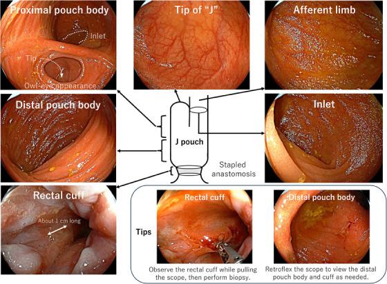 https://cdn.ncbi.nlm.nih.gov/pmc/blobs/7ac7/11058686/3acd5a1753fd/DEO2-5-e373-g001.jpg
