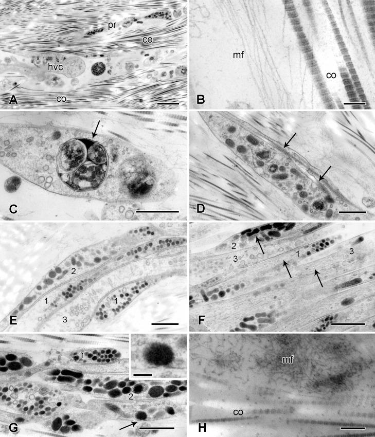 https://cdn.ncbi.nlm.nih.gov/pmc/blobs/7ac8/5156572/124f8c634347/pone.0167533.g008.jpg