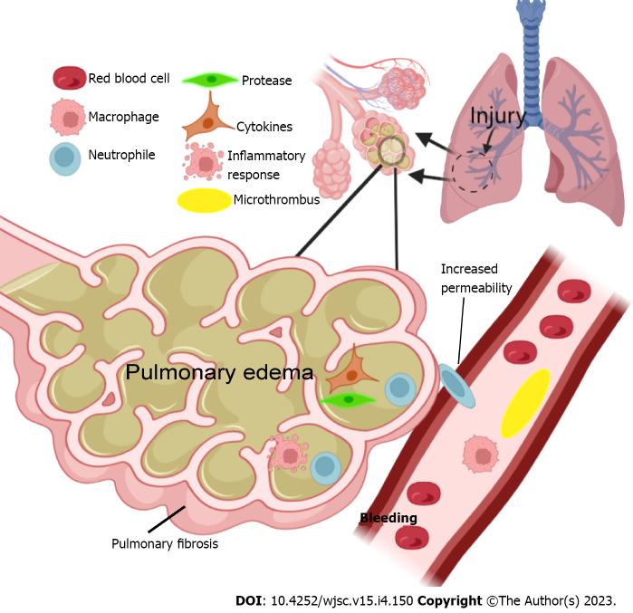 https://cdn.ncbi.nlm.nih.gov/pmc/blobs/7acd/10173811/dddac7d75f8d/WJSC-15-150-g001.jpg