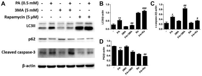 https://cdn.ncbi.nlm.nih.gov/pmc/blobs/7acf/6072221/05f100626ecb/MMR-18-02-1485-g04.jpg
