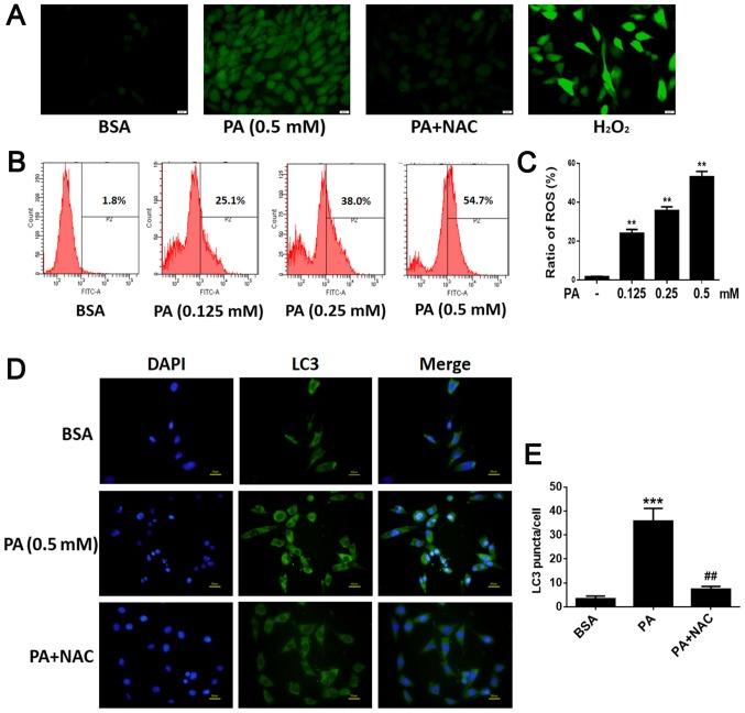 https://cdn.ncbi.nlm.nih.gov/pmc/blobs/7acf/6072221/13a26b33840f/MMR-18-02-1485-g05.jpg