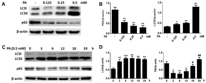 https://cdn.ncbi.nlm.nih.gov/pmc/blobs/7acf/6072221/5d582134156f/MMR-18-02-1485-g02.jpg