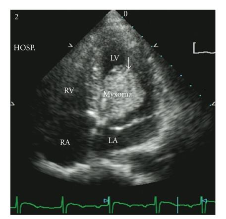 https://cdn.ncbi.nlm.nih.gov/pmc/blobs/7ad6/2997343/01daf812f08b/SRT2011-735057.001.jpg