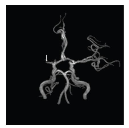 https://cdn.ncbi.nlm.nih.gov/pmc/blobs/7ad6/2997343/2703c8e8523f/SRT2011-735057.003.jpg