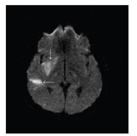 https://cdn.ncbi.nlm.nih.gov/pmc/blobs/7ad6/2997343/faa4fe1ec6e1/SRT2011-735057.002.jpg
