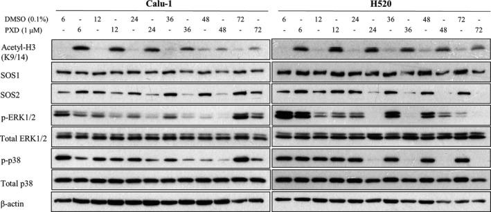 https://cdn.ncbi.nlm.nih.gov/pmc/blobs/7adf/5537707/6209cbf5c58a/MOL2-11-965-g004.jpg