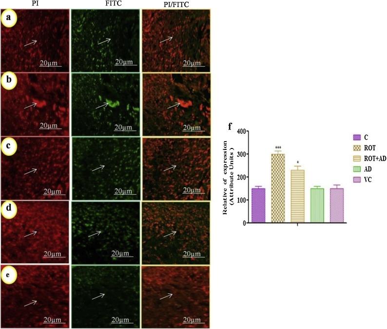 https://cdn.ncbi.nlm.nih.gov/pmc/blobs/7ae1/6526298/1e9ddd302164/gr5.jpg