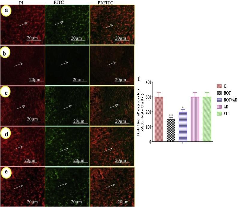 https://cdn.ncbi.nlm.nih.gov/pmc/blobs/7ae1/6526298/ea205107e76e/gr3.jpg