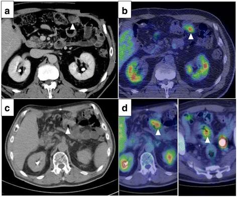 https://cdn.ncbi.nlm.nih.gov/pmc/blobs/7ae2/5643839/2e600d649690/40792_2017_386_Fig2_HTML.jpg