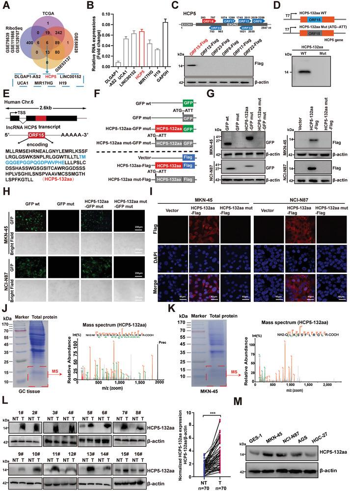 https://cdn.ncbi.nlm.nih.gov/pmc/blobs/7ae3/11633528/58c4419773e6/ADVS-11-2407012-g002.jpg