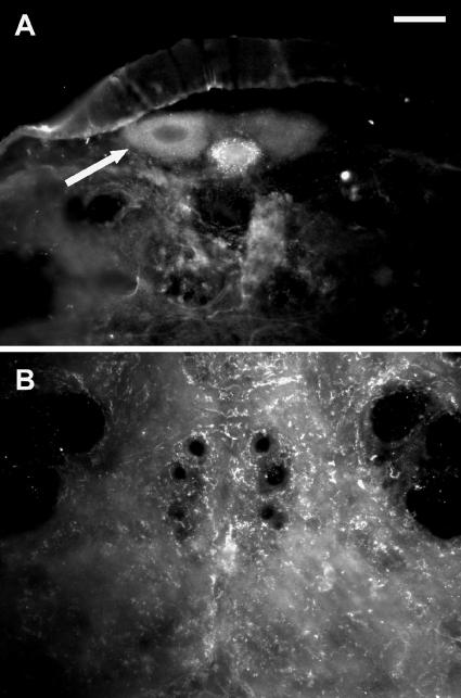 https://cdn.ncbi.nlm.nih.gov/pmc/blobs/7aea/2525928/0865fb56653a/fncel-01-003-g005.jpg