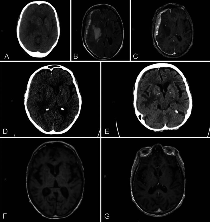 https://cdn.ncbi.nlm.nih.gov/pmc/blobs/7af2/12337981/5155b63f3c9f/CASE25347_figure_1.jpg