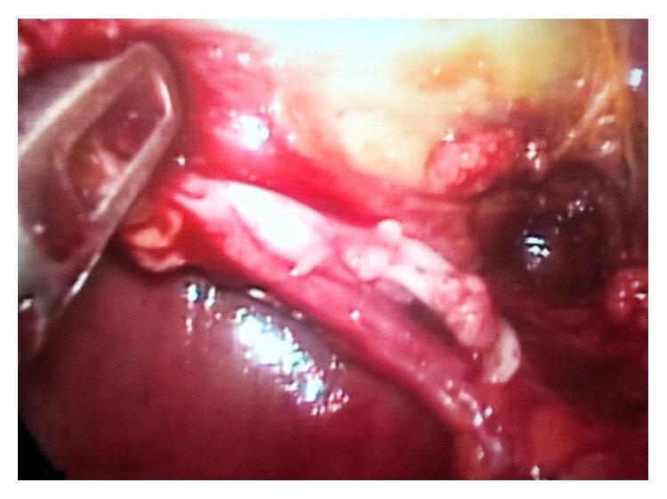 https://cdn.ncbi.nlm.nih.gov/pmc/blobs/7af3/4525758/057ac1ffcbc3/CRIS2015-589313.005.jpg