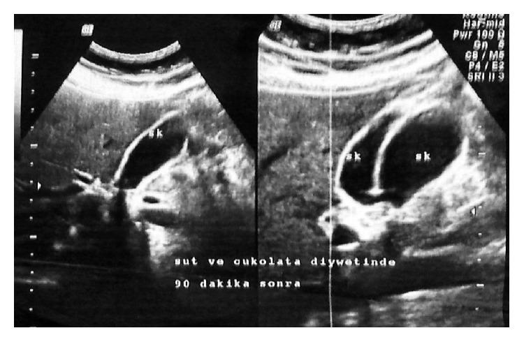 https://cdn.ncbi.nlm.nih.gov/pmc/blobs/7af3/4525758/87407e858463/CRIS2015-589313.001.jpg