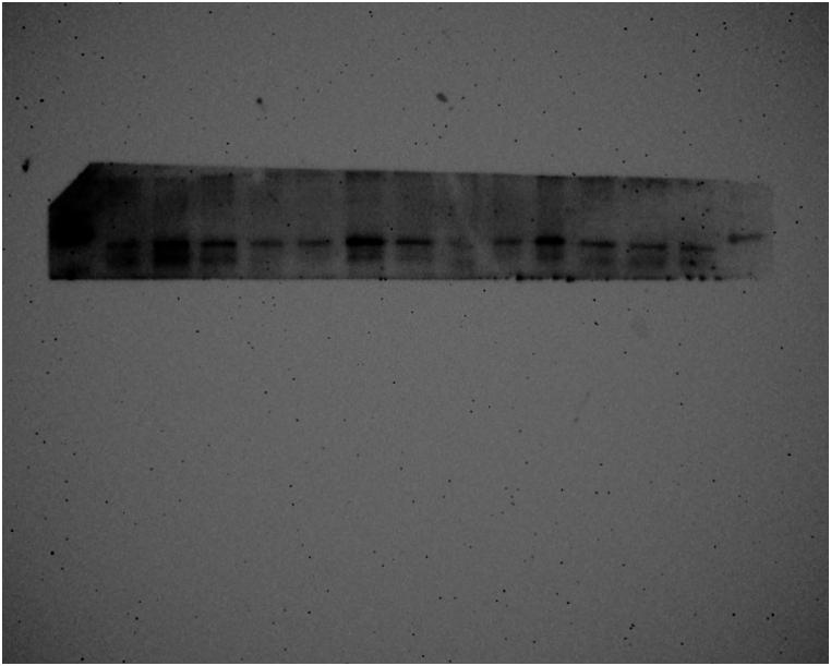 https://cdn.ncbi.nlm.nih.gov/pmc/blobs/7af5/11141264/02439c4008ca/mmcfigs7.jpg