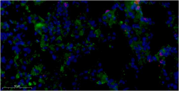https://cdn.ncbi.nlm.nih.gov/pmc/blobs/7af5/11141264/397aa15efb9c/mmcfigs4.jpg