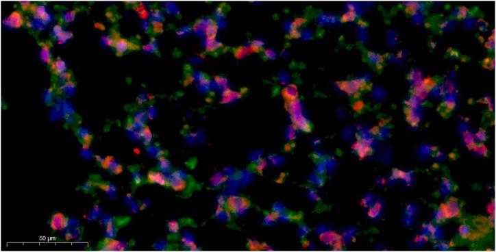 https://cdn.ncbi.nlm.nih.gov/pmc/blobs/7af5/11141264/5fe85a8c916c/mmcfigs12.jpg