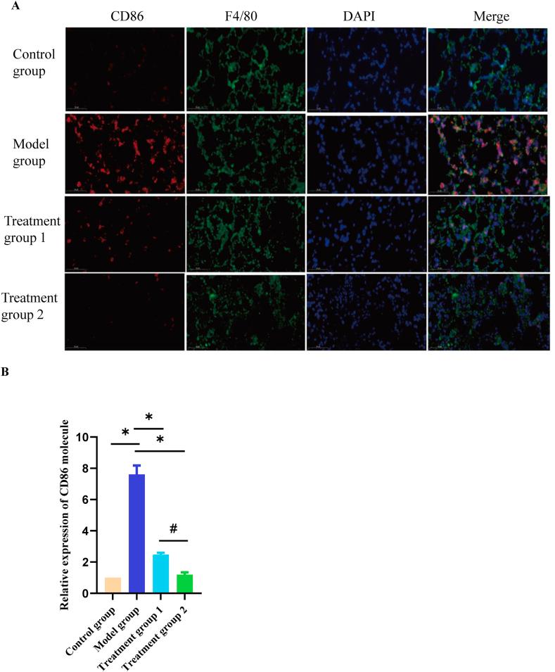 https://cdn.ncbi.nlm.nih.gov/pmc/blobs/7af5/11141264/654f395ece18/gr2a.jpg