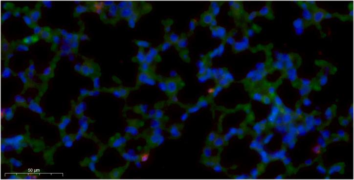 https://cdn.ncbi.nlm.nih.gov/pmc/blobs/7af5/11141264/7256d7d02f13/mmcfigs10.jpg
