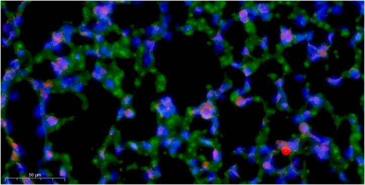 https://cdn.ncbi.nlm.nih.gov/pmc/blobs/7af5/11141264/9f4a88f5e0da/mmcfigs2.jpg