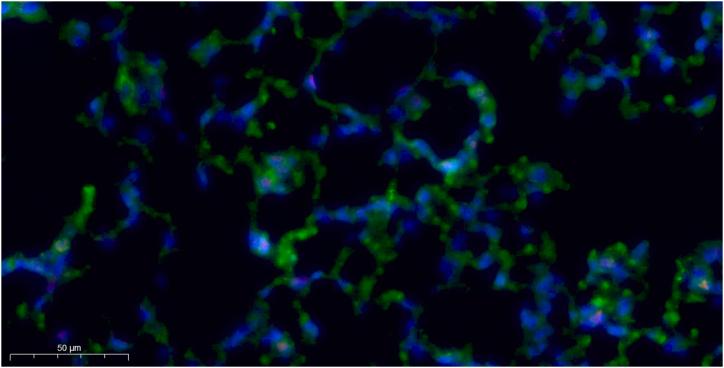 https://cdn.ncbi.nlm.nih.gov/pmc/blobs/7af5/11141264/a20303a66127/mmcfigs9.jpg