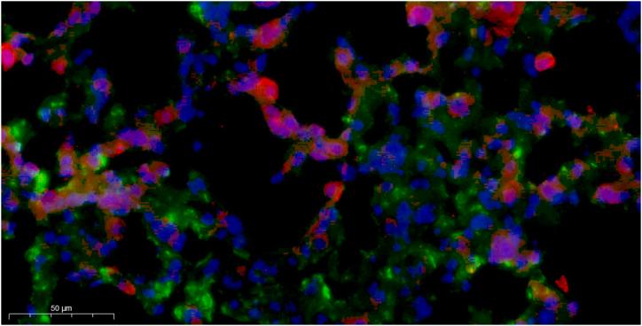 https://cdn.ncbi.nlm.nih.gov/pmc/blobs/7af5/11141264/d86fabd55c80/mmcfigs3.jpg