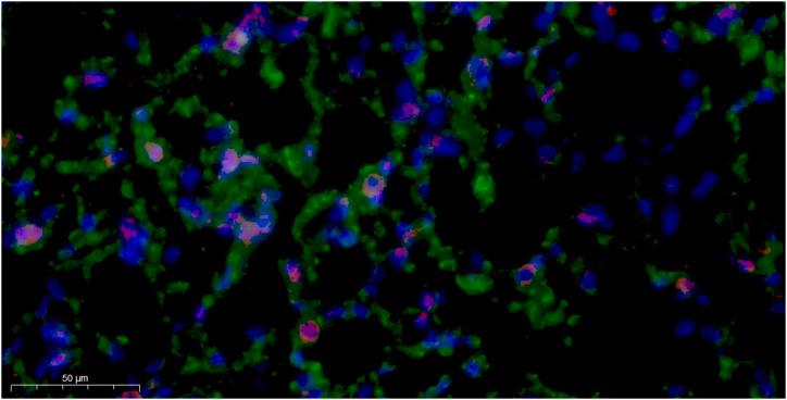 https://cdn.ncbi.nlm.nih.gov/pmc/blobs/7af5/11141264/ee268619b9f5/mmcfigs1.jpg