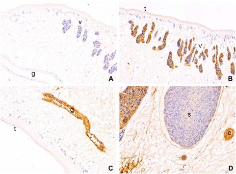 https://cdn.ncbi.nlm.nih.gov/pmc/blobs/7af7/2654340/752ed8c17d57/pntd.0000398.g005.jpg