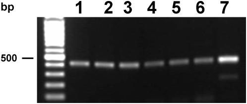 https://cdn.ncbi.nlm.nih.gov/pmc/blobs/7af7/2654340/c969052a7239/pntd.0000398.g004.jpg