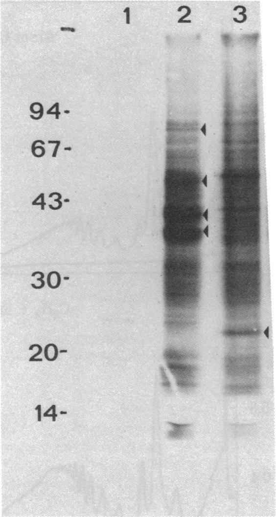 https://cdn.ncbi.nlm.nih.gov/pmc/blobs/7af7/346576/da367c30e78d/pnas00452-0135-b.jpg