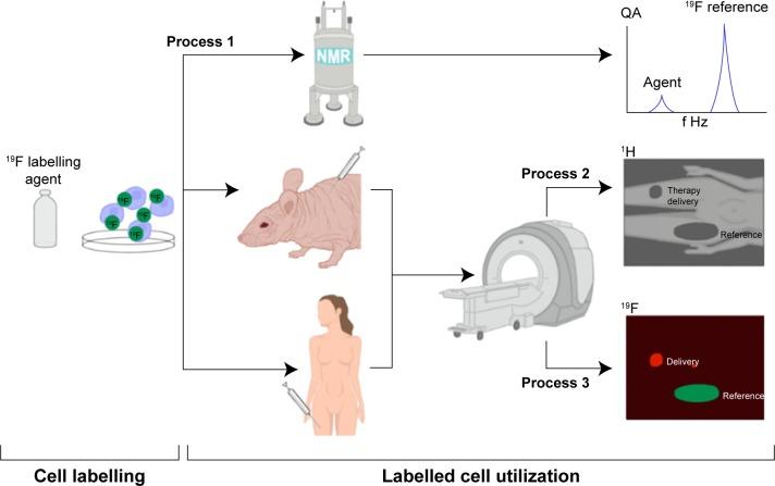 https://cdn.ncbi.nlm.nih.gov/pmc/blobs/7b01/4807887/1175aabd0f5c/mri-suppl.1-2015-053f2.jpg