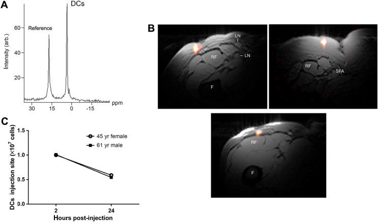 https://cdn.ncbi.nlm.nih.gov/pmc/blobs/7b01/4807887/1955b2f1a436/mri-suppl.1-2015-053f4.jpg
