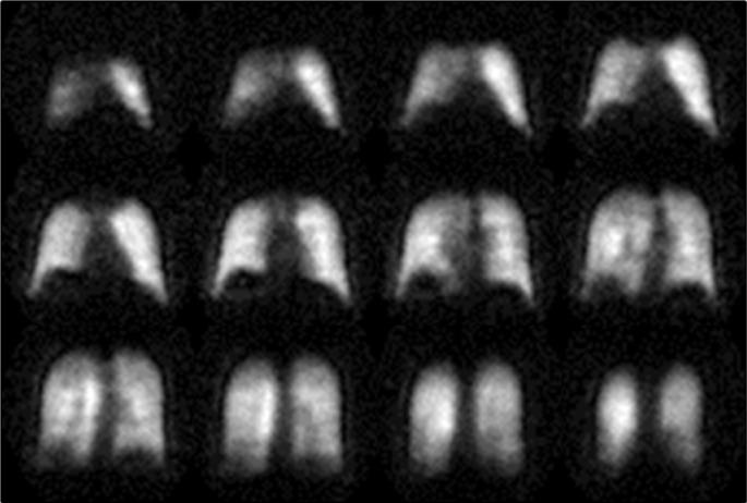 https://cdn.ncbi.nlm.nih.gov/pmc/blobs/7b01/4807887/328996b5d7e1/mri-suppl.1-2015-053f6.jpg