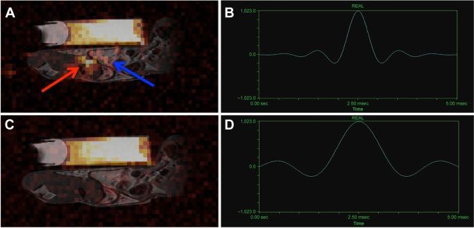 https://cdn.ncbi.nlm.nih.gov/pmc/blobs/7b01/4807887/e218deaaa251/mri-suppl.1-2015-053f3.jpg