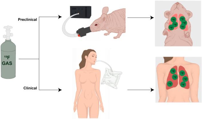 https://cdn.ncbi.nlm.nih.gov/pmc/blobs/7b01/4807887/e5cb1a764098/mri-suppl.1-2015-053f5.jpg