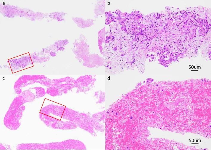 https://cdn.ncbi.nlm.nih.gov/pmc/blobs/7b03/10590314/27670b81433e/535_2023_2037_Fig2_HTML.jpg