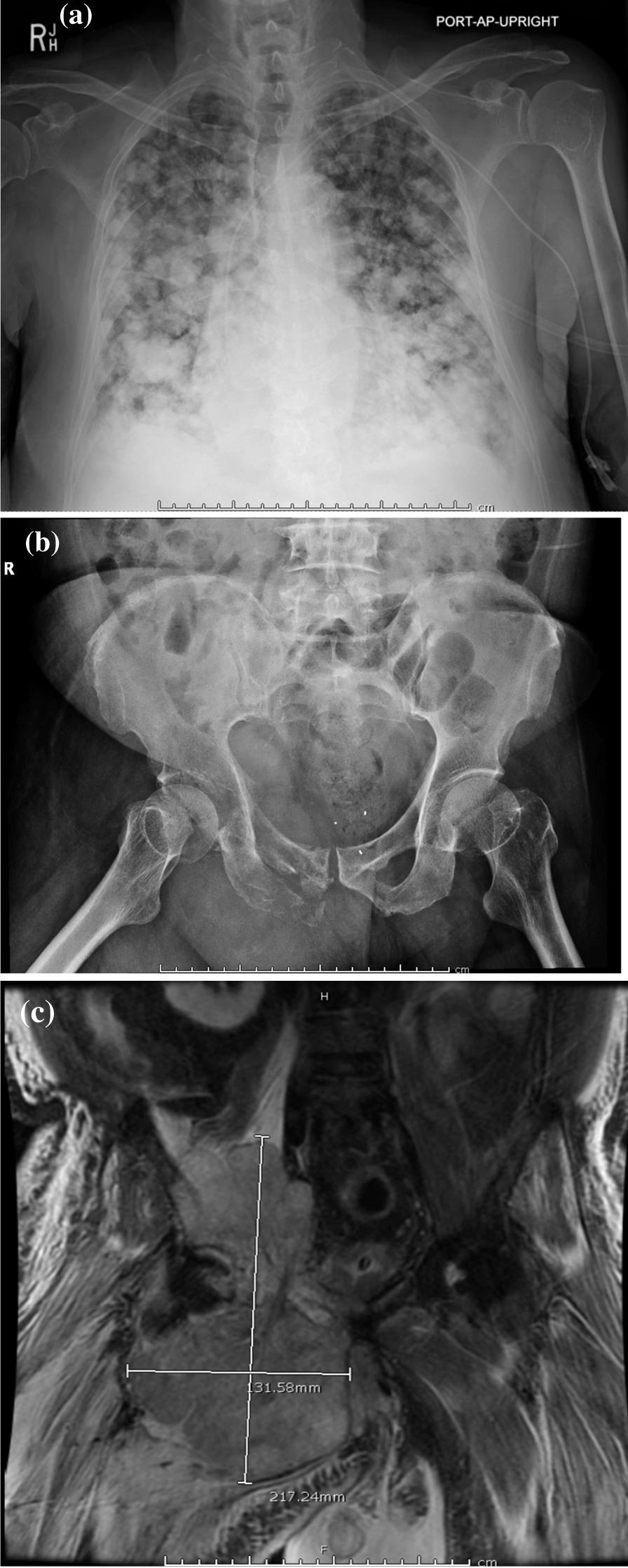 https://cdn.ncbi.nlm.nih.gov/pmc/blobs/7b0a/9238137/523c6003a34d/13256_2022_3469_Fig1_HTML.jpg