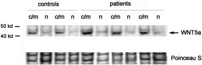 https://cdn.ncbi.nlm.nih.gov/pmc/blobs/7b0f/2670517/cf84c42d5e39/pone.0005354.g004.jpg