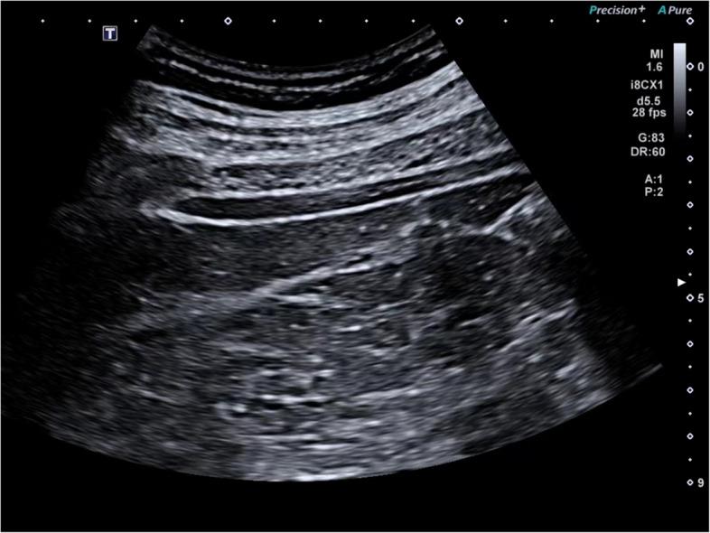 https://cdn.ncbi.nlm.nih.gov/pmc/blobs/7b1b/12210429/35e7526f517f/40814_2025_1673_Fig4_HTML.jpg