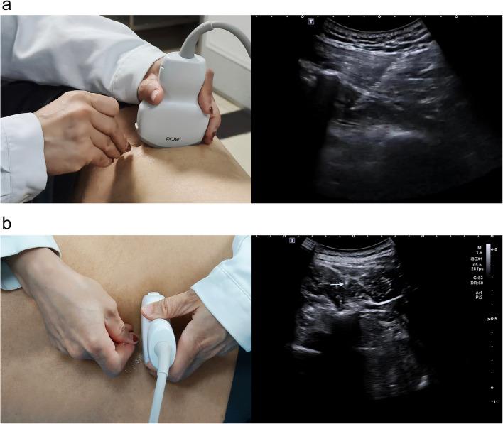 https://cdn.ncbi.nlm.nih.gov/pmc/blobs/7b1b/12210429/8216c6a00fdb/40814_2025_1673_Fig7_HTML.jpg